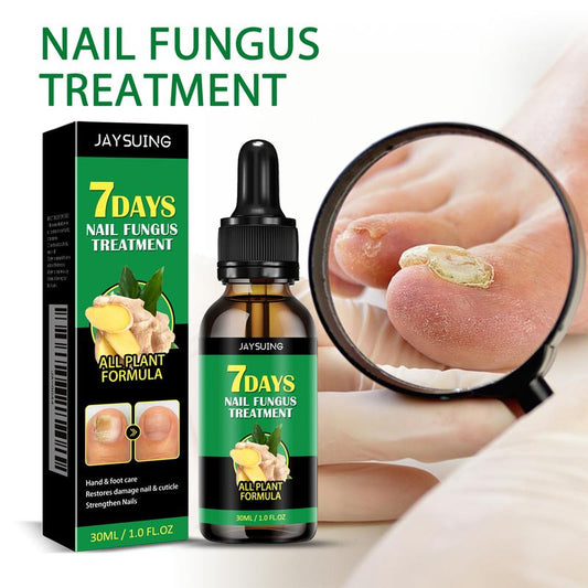 Ginger Nail Revive Nail Care Set