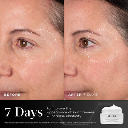 Advanced Youth Renewal Cream